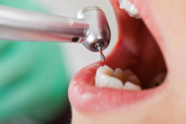 Best Emergency Dental Care for Sports Injuries in Baldwin, MI